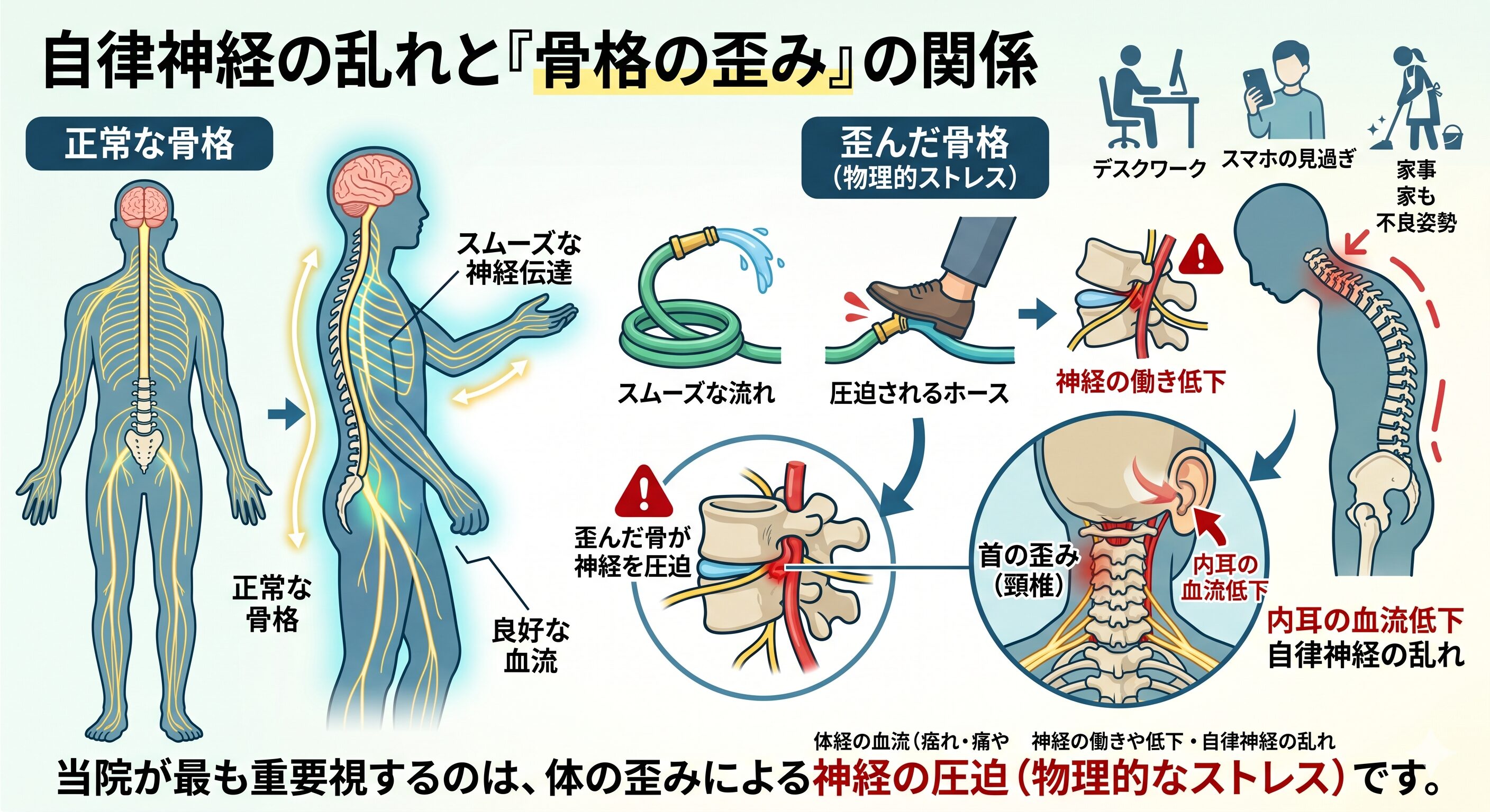 自律神経の乱れと『骨格の歪み』の物理的な関係(神経圧迫)を解説するインフォグラフィック。正常な骨格と歪んだ骨格(首、背骨、骨盤)、デスクワーク、スマホ見過ぎ、家事など不良姿勢による自律神経への負担(ホースの圧迫)と、内耳の血流低下を解説。