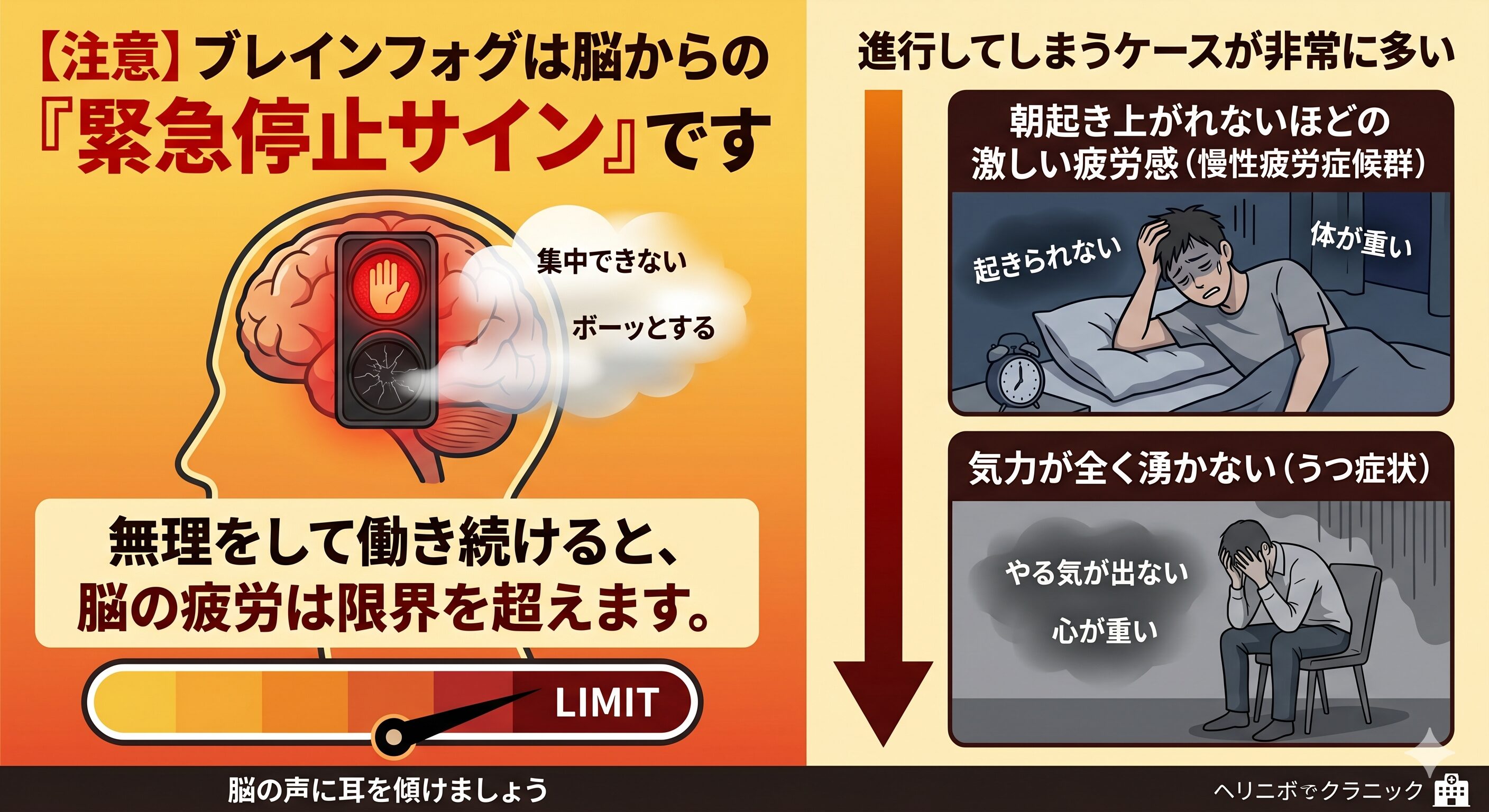 ブレインフォグは脳からの緊急停止サイン。無理して働き続けると脳の疲労が限界を超え、慢性疲労症候群やうつ症状に進行してしまう危険性を説明する図解。
