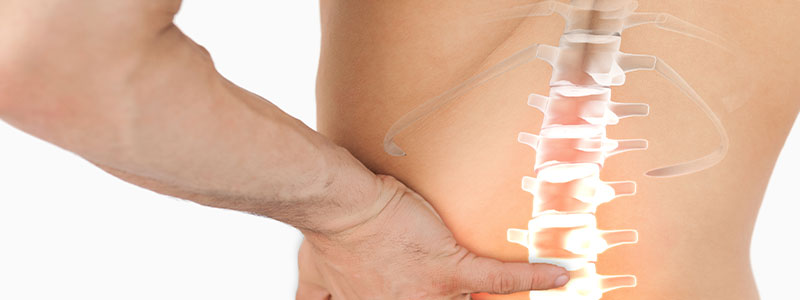 腰椎ヘルニアイメージ